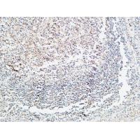Prothrombin Polyclonal Antibody