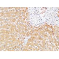 Prothrombin Polyclonal Antibody
