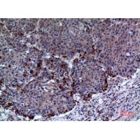 PRX I Polyclonal Antibody