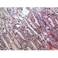 pS2 Polyclonal Antibody