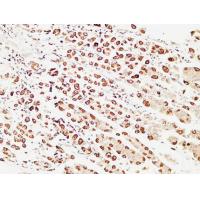 pS2 Polyclonal Antibody