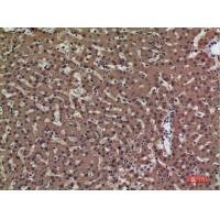 PSG1 Polyclonal Antibody