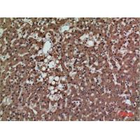 PSG1 Polyclonal Antibody