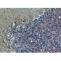 PSGL-1 Polyclonal Antibody