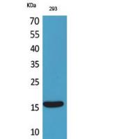 PSP Polyclonal Antibody