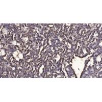 PSP Polyclonal Antibody