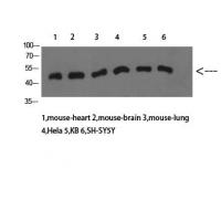 PTEN Polyclonal Antibody