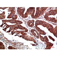 PTEN Polyclonal Antibody