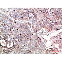 PTEN Polyclonal Antibody