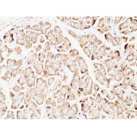 PTEN Polyclonal Antibody