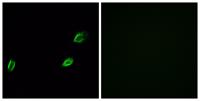 Photomedin-1 Polyclonal Antibody