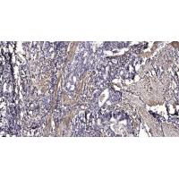 PI 3-Kinase C2γ Polyclonal Antibody