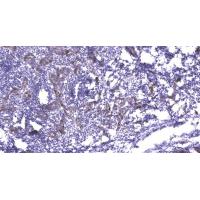 PI 3 Kinase Class 3 Polyclonal Antibody