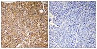 PI 3-Kinase p110γ Polyclonal Antibody