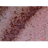 PI 3-Kinase p110δ Polyclonal Antibody