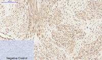 PI 3 kinase p85α/γ Polyclonal Antibody