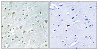 PIG-X Polyclonal Antibody