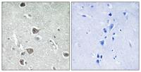 AASD-PPT Polyclonal Antibody
