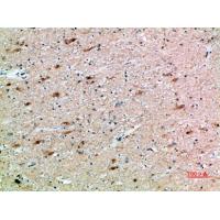 FSHβ Polyclonal Antibody