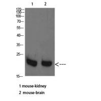 RHEB Polyclonal Antibody