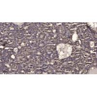 RHEB Polyclonal Antibody
