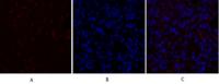 PDPK1 Polyclonal Antibody