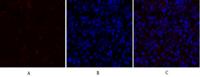 PDPK1 Polyclonal Antibody