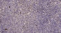 PDZ-RhoGEF Polyclonal Antibody