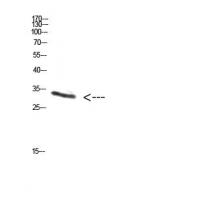PENK Polyclonal Antibody