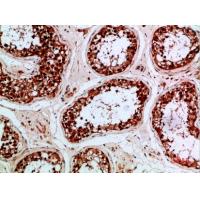 PENK Polyclonal Antibody