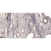 PENK Polyclonal Antibody