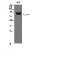 Perforin 1 Polyclonal Antibody
