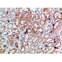 Perforin 1 Polyclonal Antibody