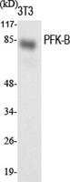 PFK-B Polyclonal Antibody