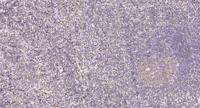 PGBD1 Polyclonal Antibody