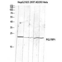 PGLYRP1 Polyclonal Antibody