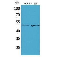 PD-ECGF Polyclonal Antibody