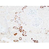 PD-ECGF Polyclonal Antibody