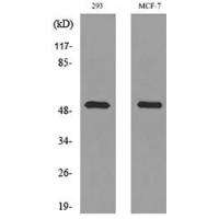 PD-ECGF Polyclonal Antibody