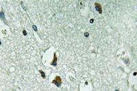 PAH Polyclonal Antibody