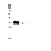 Pan myristoylation  Polyclonal Antibody