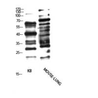 Pan glycine myristoylation  Polyclonal Antibody