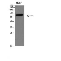 Parathyroid hormone/parathyroid hormone-related peptide receptor Polyclonal Antibody