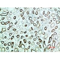 Parathyroid hormone/parathyroid hormone-related peptide receptor Polyclonal Antibody