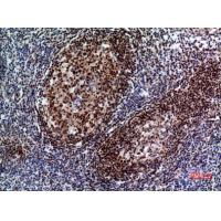 Pax-5 Polyclonal Antibody