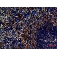 Pax-5 Polyclonal Antibody