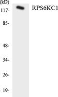 p52 S6 kinase Polyclonal Antibody
