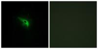 p53AIP1 Polyclonal Antibody
