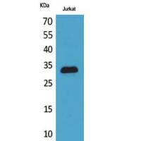 p57 Polyclonal Antibody