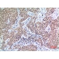 p57 Polyclonal Antibody
